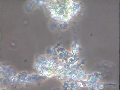 Examen des boues activées de la station de Donges (bassin D11 A)