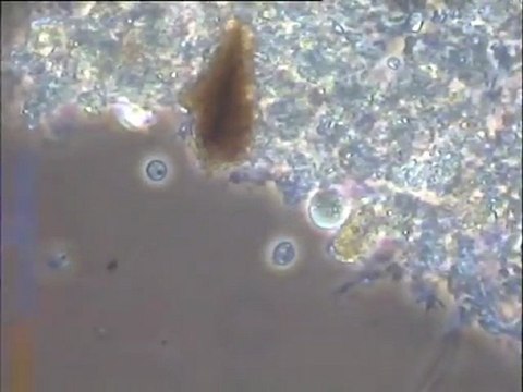 Examen des boues activées du pilote de la station de Valenton