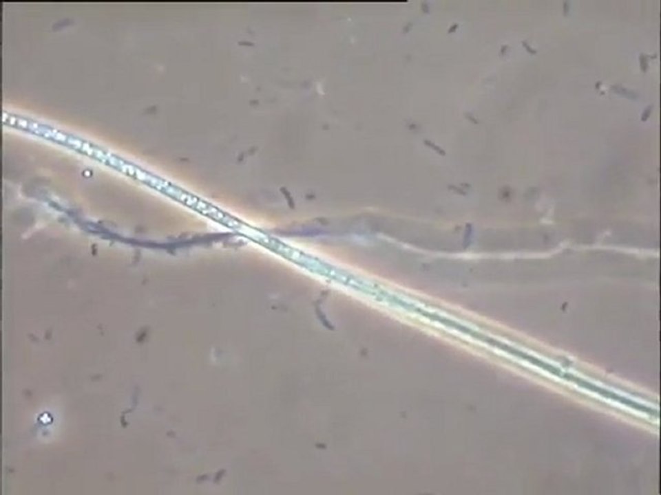 Examen au microscope de plusieurs boues activées de stations différentes (Marseille, Le Mans, Colombes)