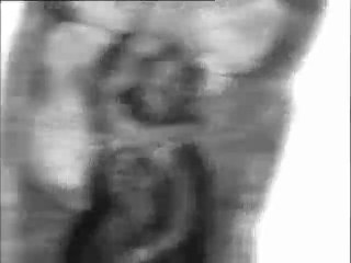 Etude anatomique d'un ver oligochète - examen au microscope