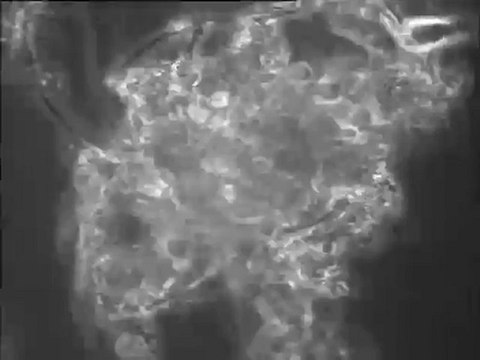 Examen de boue activée de lagune - examen d'une goutte de mousse