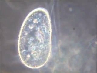 Examen d'un prélèvement d’eau du pilote d'Orly après réensemencement