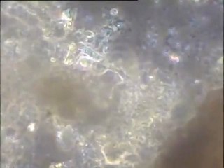 Observation de prélèvements de sédiment de l'étang des Noës : détail de la microfaune