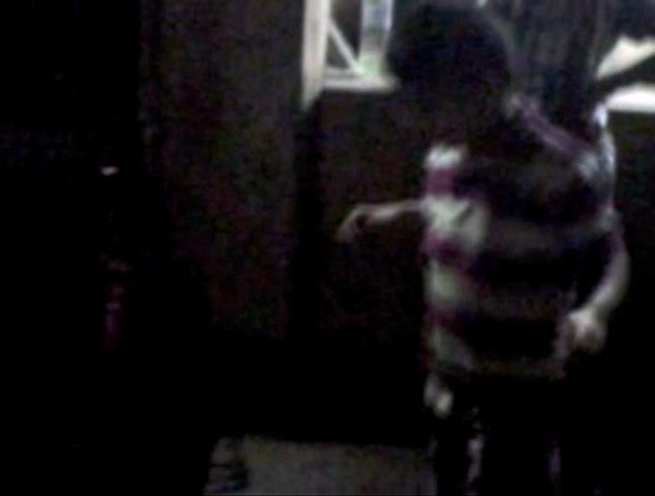 when dog atacks a child