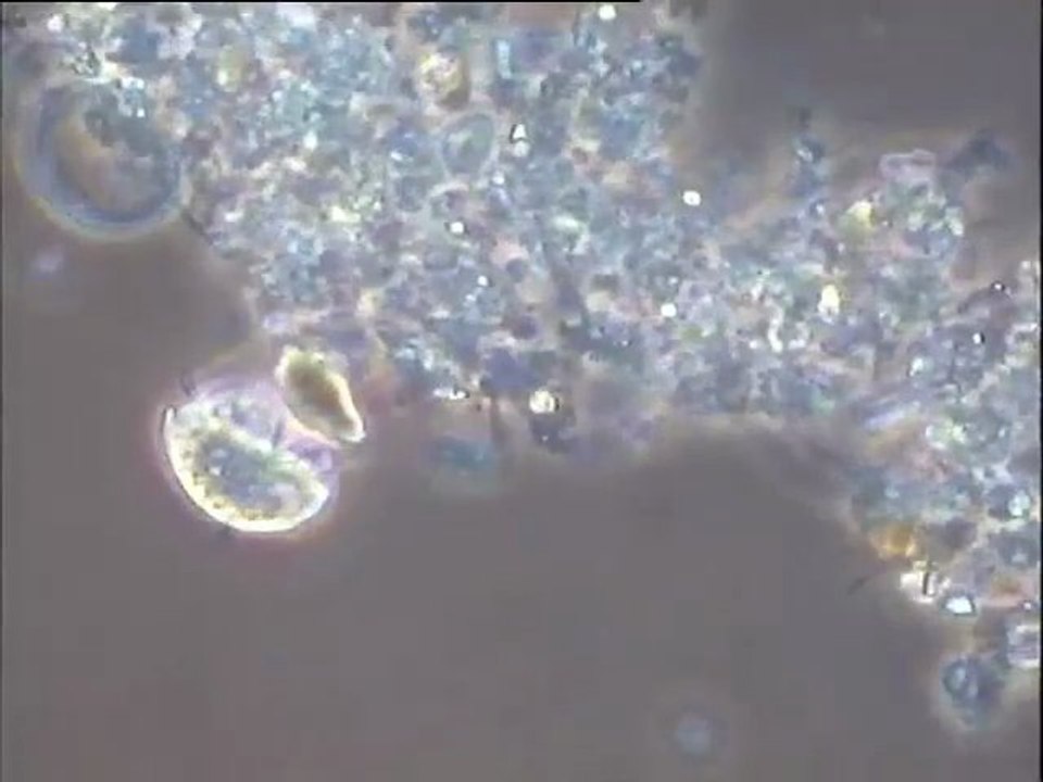 Examen d'une boue à fort grossissement : observation de la microfaune