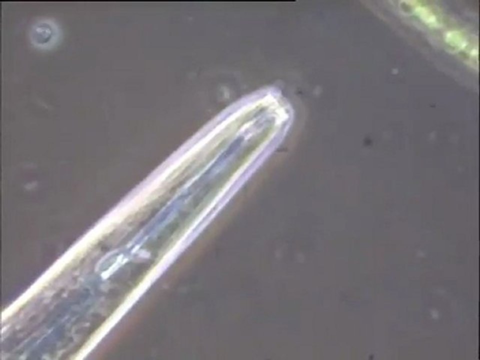 Détail de la microfaune d'un floc