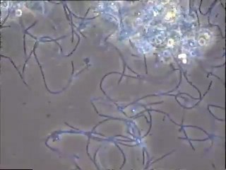 Examen d'une boue filamenteuse traitée au chlore