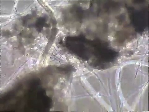 Examen à fort grossissement d'une boue âgée montrant des rotifères, des ciliés Spirotriches et des nématodes (bassins d'Orly)