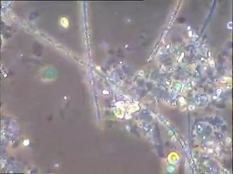 Observation de différentes bactéries du soufre