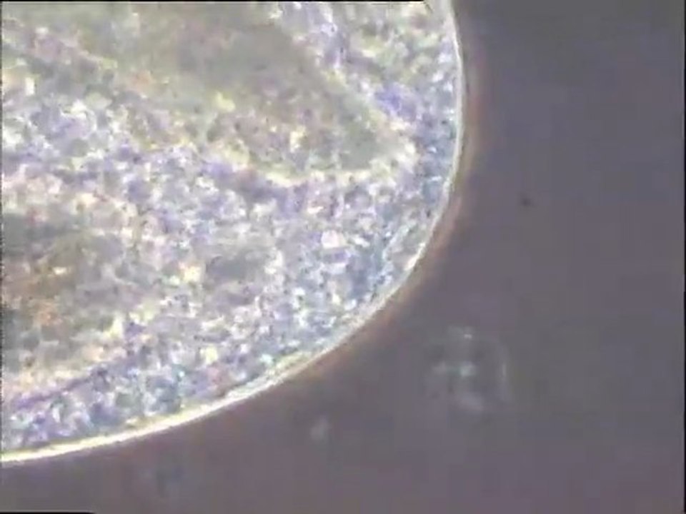 Prédation de rotifères par un Cilié Holotriche (Prorodon)