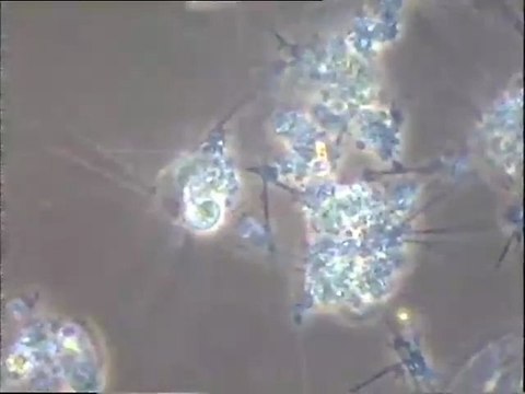 Examen de la microfaune des boues de la station d'épuration de Vegt (Dordogne) : prélèvement du STEP