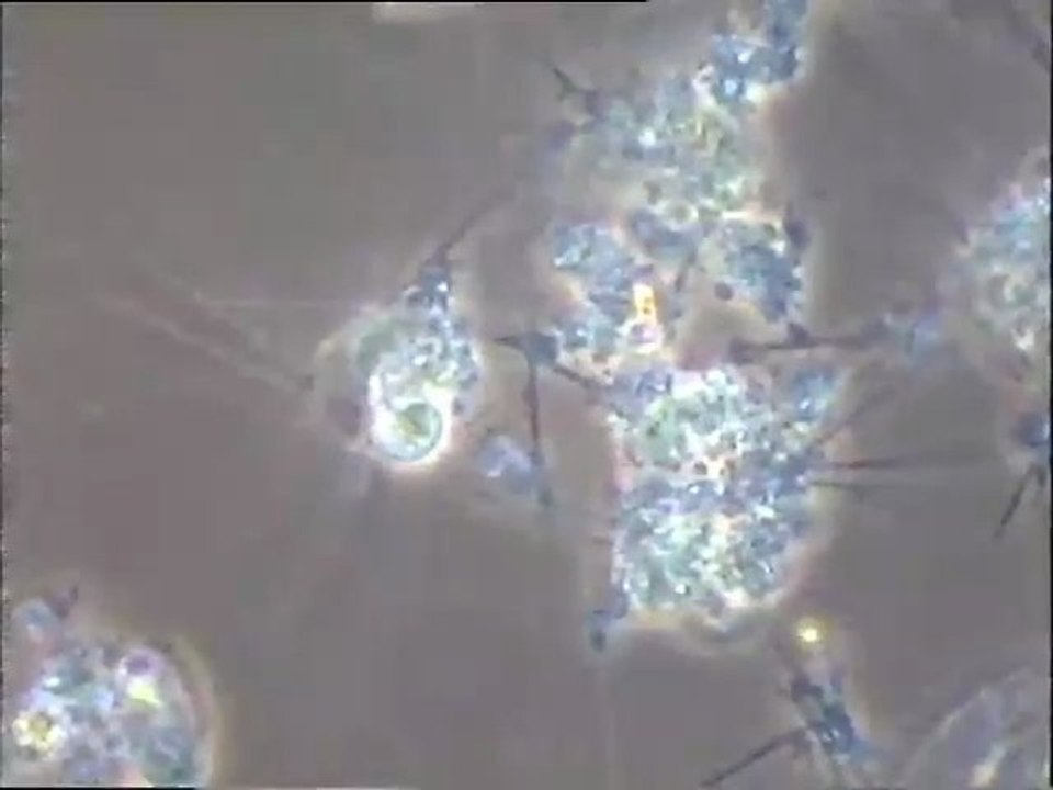 Examen de la microfaune des boues de la station d'épuration de Vegt (Dordogne) : prélèvement du STEP