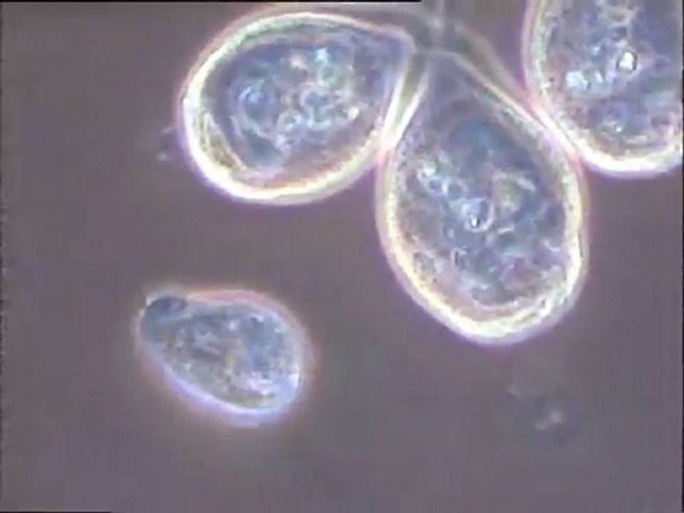 Observation de la faune protozoaire d'une boue activée en gros plan (boues du S5)