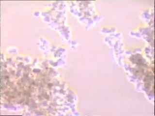 Examen d'une boue activée âgée à rotifères à plusieurs grossissements