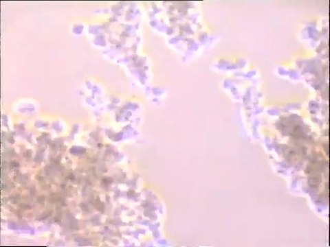 Examen d'une boue activée âgée à rotifères à plusieurs grossissements