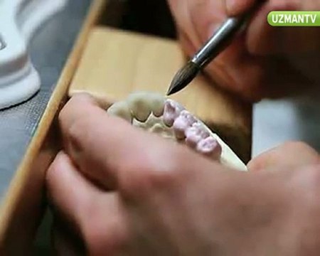 Dr. Nihat Tanfer - Diş implantı taktırmanın avantajları nelerdir-