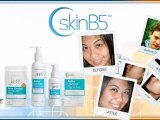 Pimples, Vitamin B5, Acne Cures, Acne Vitamins, Best Acne Treatment, Acne, Cure For Acne