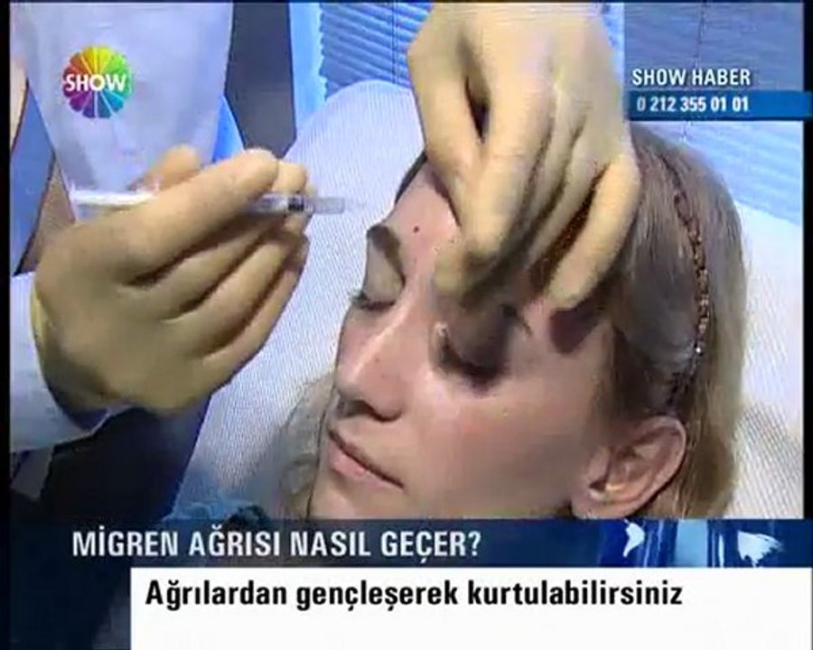 Op. Dr. Abdülkadir Göksel , Botox  ile migren tedavisi