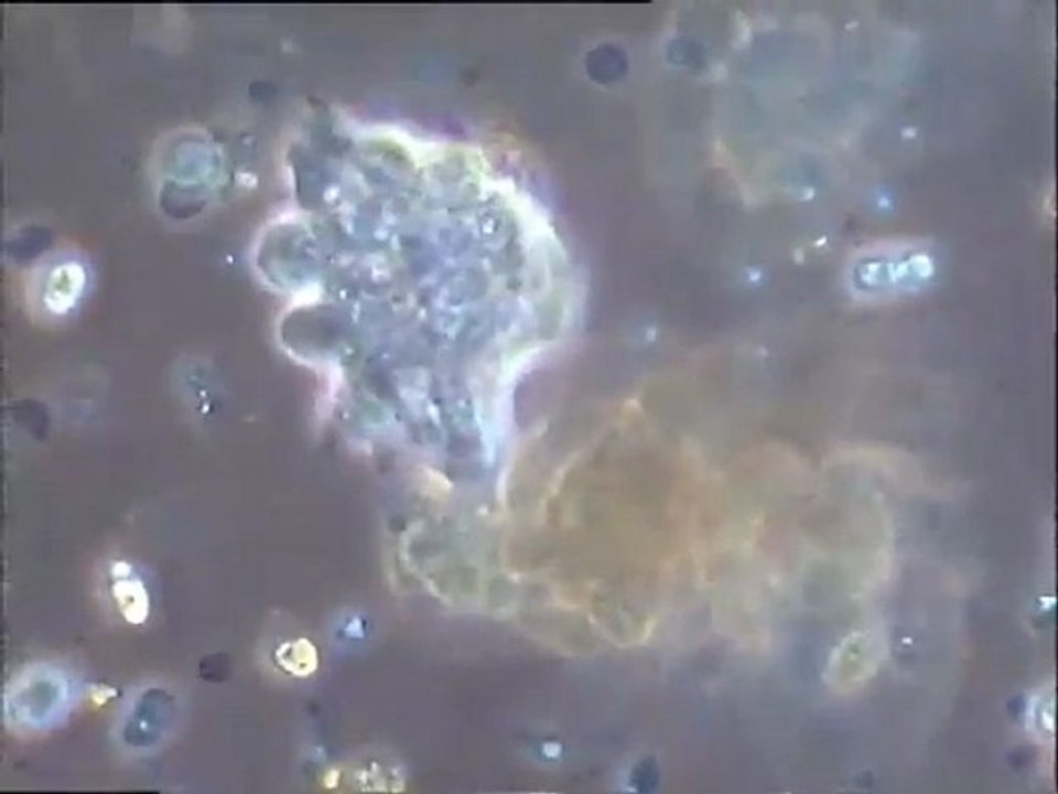 Examen de biomassses d'effluents  vinicoles : échantillon témoin et boues traitées