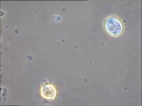 Examen de prélèvements faits dans des effluents vinicoles : boue native et exsudat liquide