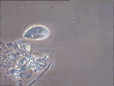 Images de cristallisation après évaporation d'un échantillon d'effluent vinicole