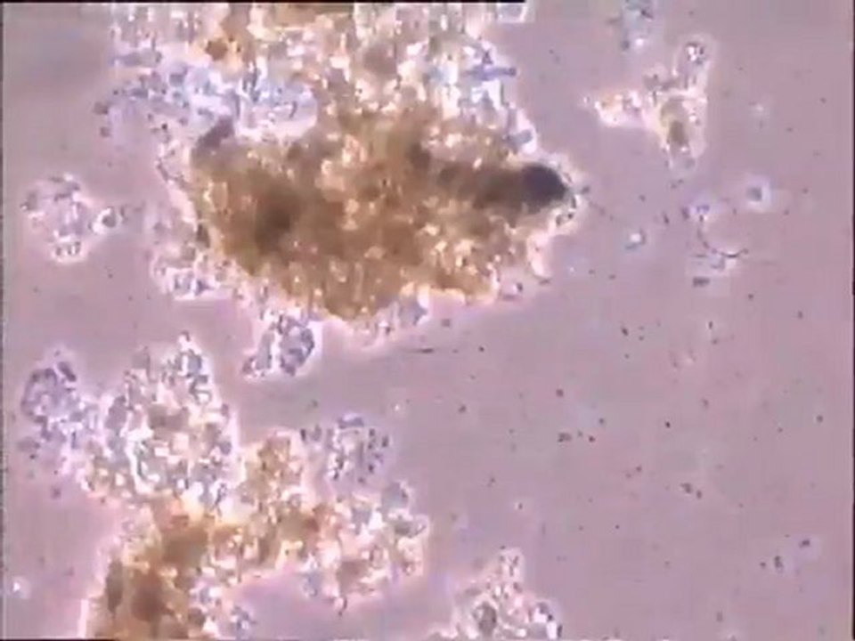Examen d'un ancien échantillon de boue activée de 15 jours : observation de la microfaune restante