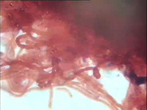 Coloration Gram des biomasses des boues activées de station d'épuration de papeterie UPM : observation de flocs filamenteux