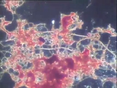 Coloration Gram des biomasses UPM : examen à fort grossissement des flocs filamenteux