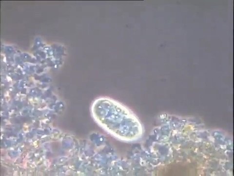 Observation d'une colonne de Winogradsky : examen de la microfaune et des filaments de Beggiatoa