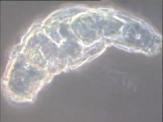 Microfaune d'une boue de Noisy-le-Grand, à très fort grossissement : examen des espèces