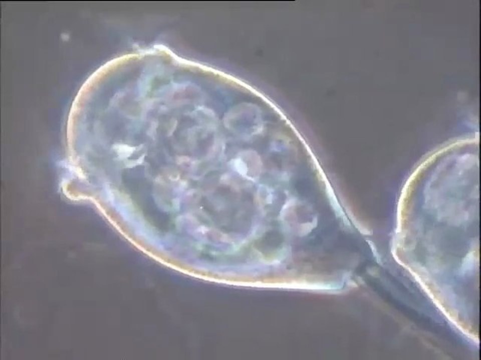 Examen d'une boue activée de Noisy-le-Grand : observation de Vorticelles