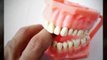 Wichita Dentist Answers FAQ2: What Are Dental Insurance Coverage Types?