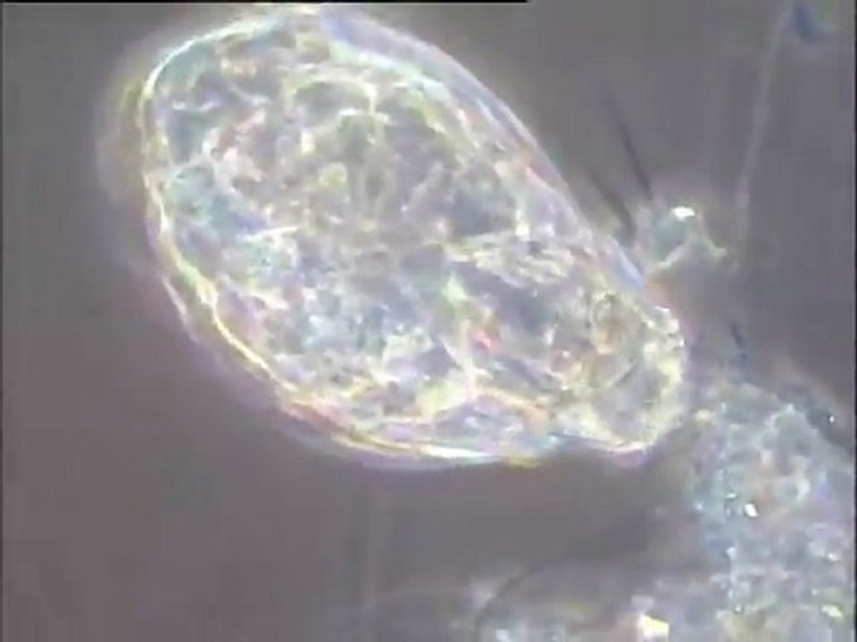 Prédation : ingestion de floc et de plusieurs filaments par un rotifère