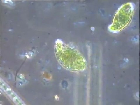 Observation d'algues dans un prélèvement du bassin combiné d'Achères III