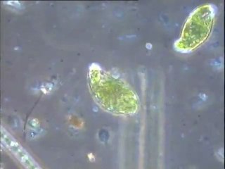 Observation d'algues dans un prélèvement du bassin combiné d'Achères III