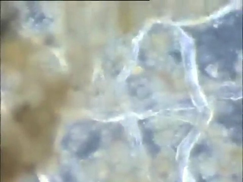 Examen des boues du Densadeg, dans l'état naturel puis diluées à l'eau distillée