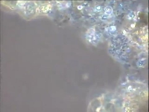 Examen des boues de lavage du Biofor de la station Seine centre