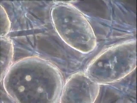 Examen des prélèvements faits à Achères IV sur deux emplacements avant l'expérience à l'eau oxygénée (pour éliminer les filaments)