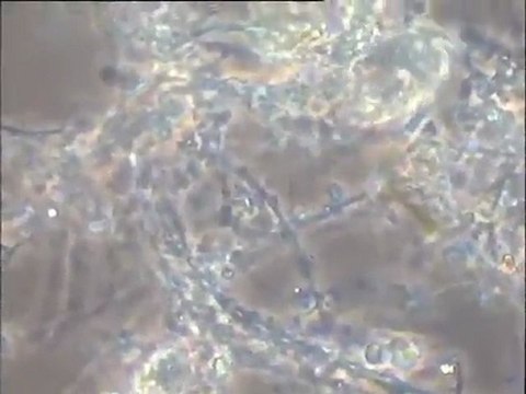 Examen d'échantillons de boues âgées à thécamibes