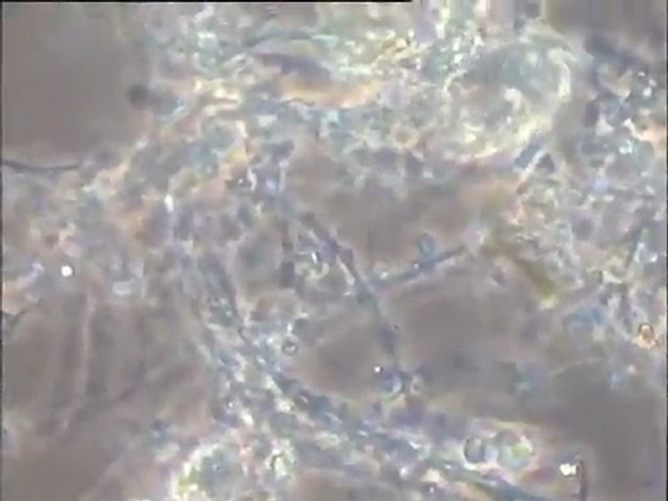 Examen d'échantillons de boues âgées à thécamibes