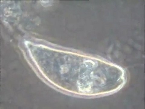 Examen des biomasses d'une boue de lavage du pilote de dénitrification Biostyr