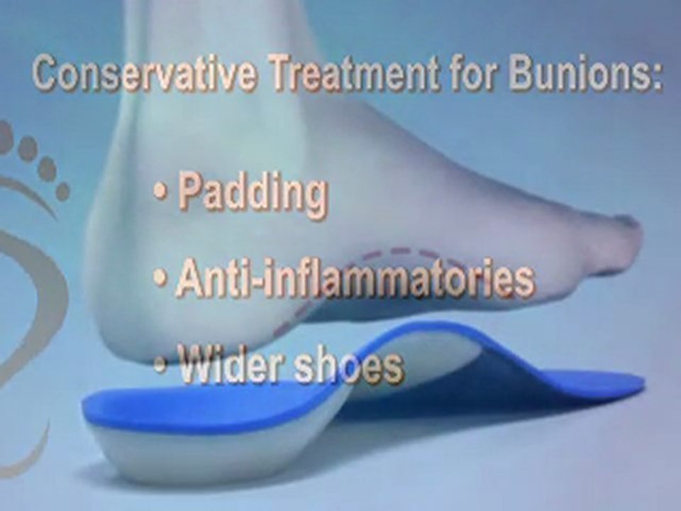 Bunions - Podiatrist in Bethesda, MD and Springfield, VA