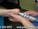 Shock Wave Therapy for Foot Pain - Podiatrist in Bethesda, MD and Springfield, VA