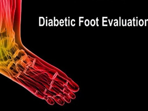 Peripheral Neuropathy - Podiatrist in Bethesda, MD and Springfield, VA