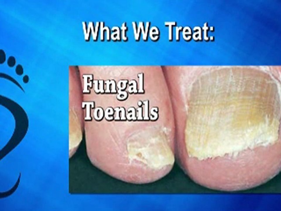 What is a Podiatrist? - Podiatrist in Bethesda, MD and Springfield, VA