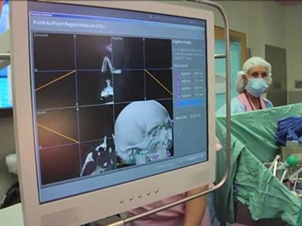 US man gets 'most extensive' face transplant ever