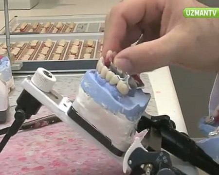 Dr.Nihat Tanfer - Protez diş nedir