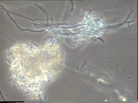 Examen de la boue activée du bassin B d’Achères : observation des biomasses au démarrage du traitement au Nutriox