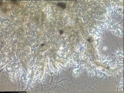 Examen d’une préparation de boue activée de la file A d’Achères, après un jour de traitement au Nutriox : observation en fond noir et en contraste de la densité et de la morphologie des flocs et des filaments