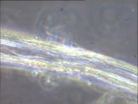 Examen des biomasses rencontrées dans un sédiment profond (anoxique)